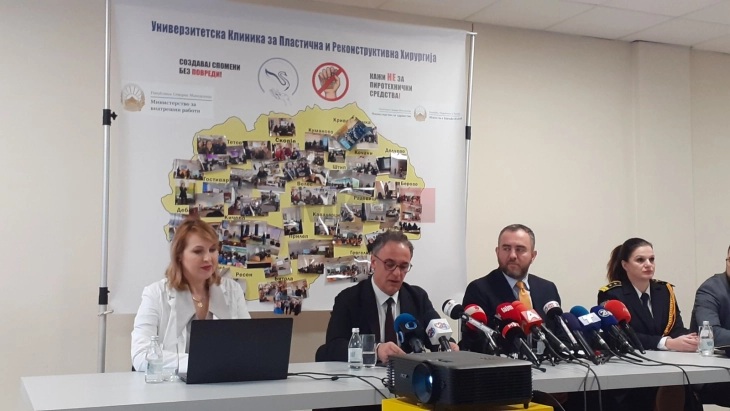 КАЖИ НЕ НА ПИРОТЕХНИКАТА: Петардите не се играчка, 5 деца завршија на клиниките и, за жал, некои од нив и со ампутација